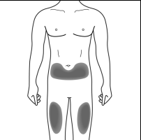 Schema del corpo umano con aree ombreggiate che indicano possibili siti di iniezione nell