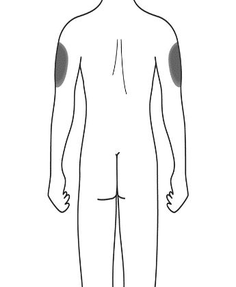 Schema del corpo umano con evidenziate in grigio le aree consigliate per l