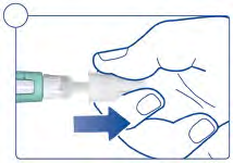 Mano che tiene una siringa preriempita con ago e punta verso il basso una freccia blu indica la direzione di iniezione
