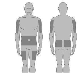 Schema anatomico di figura umana frontale e dorsale con aree ombreggiate su braccia e cosce
