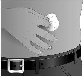 Mano che tiene un batuffolo di cotone sulla zona di iniezione addominale con cintura e fibbia visibili