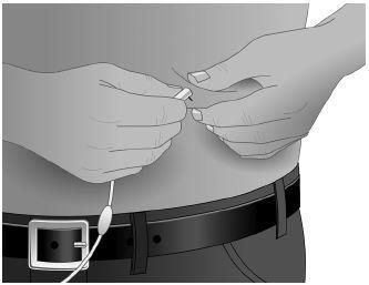 Due mani che tengono e manipolano un dispositivo medico bianco con un filo sottile collegato a una clip da cintura