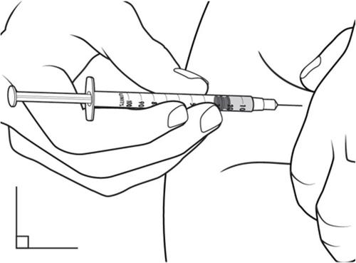 Mano che tiene una siringa con ago inserito nel braccio, tecnica di iniezione sottocutanea con angolo di circa 45 gradi