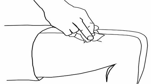 Mano che solleva un lembo di pelle con le dita per preparare un