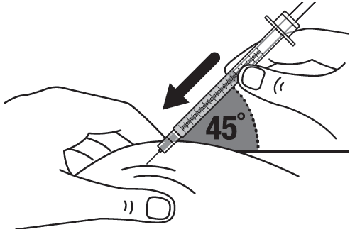 Mano che tiene una siringa inclinata a 45 gradi mentre inietta il farmaco nel braccio con freccia nera indicante la direzione