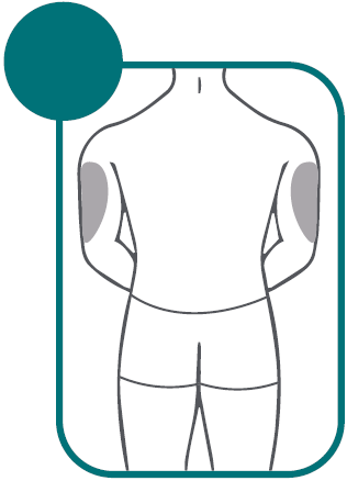 Schizzo di schiena umana con aree grigie ombreggiate che indicano i possibili siti di iniezione intramuscolare nelle spalle e nei glutei