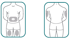 Schema corporeo con aree evidenziate per iniezione sottocutanea addominale e glutei laterali
