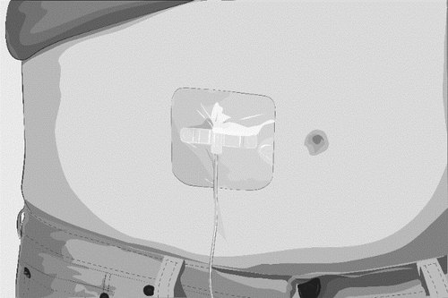 Cerotto adesivo rettangolare applicato sull