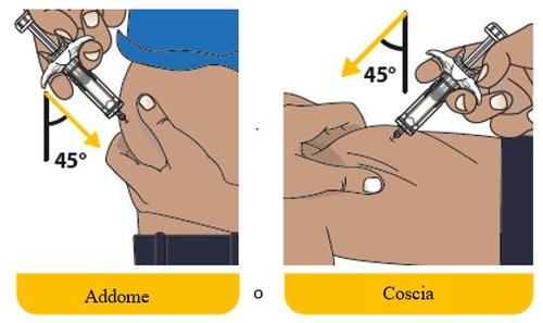 Iniezione sottocutanea con siringa a 45 gradi su addome e coscia con indicazione dell