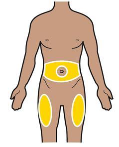 Torso umano stilizzato con evidenziate in giallo le zone di iniezione sottocutanea addominale e glutea