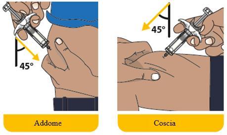 Iniezione sottocutanea con siringa a 45 gradi su addome e coscia, frecce indicano l