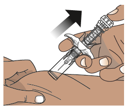 Mano che tiene una siringa preriempita con ago inserito nella pelle, freccia nera indica la direzione dell