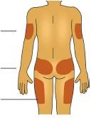 Schema del corpo umano da dietro con aree colorate in arancione che indicano possibili siti di iniezione su braccia, glutei e cosce