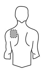 Schema del corpo umano con area ombreggiata sul deltoide destro indicando il sito di iniezione intramuscolare