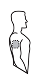 Profilo stilizzato di una spalla e parte del torace con area ombreggiata a puntini che indica il sito di iniezione