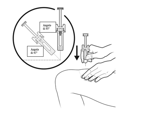 Mano che inietta farmaco sottocute con siringa, angoli di 45&deg; e 90&deg; indicati, freccia mostra direzione di inserimento ago nel braccio