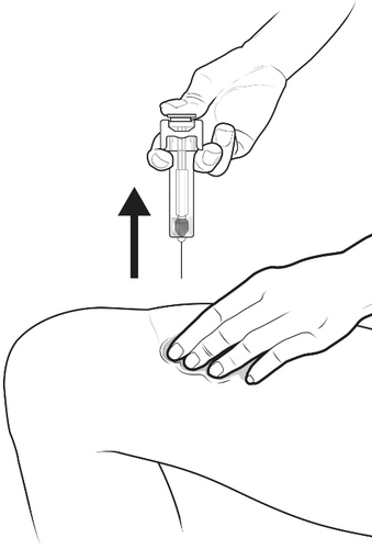 Mano che tiene una siringa preriempita con ago inserito nella pelle, freccia nera indica direzione di iniezione su coscia