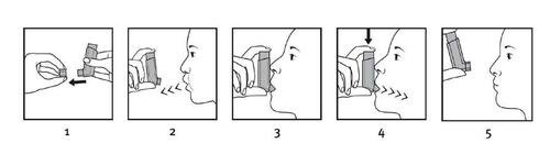 Sequenza di cinque disegni che mostrano l