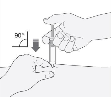 Mano che tiene una siringa ad angolo retto mentre inietta il farmaco nella pelle del braccio, con indicazione dell