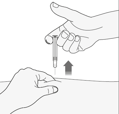 Mano che tiene un dispositivo per iniezione sottocutanea con ago rivolto verso la pelle della mano inferiore freccia indica la direzione