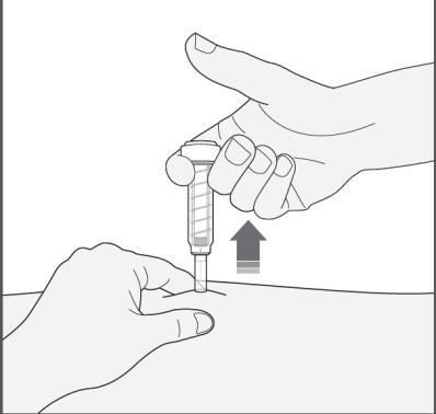 Mano che tiene una penna per iniezione con ago inserito nella pelle, freccia indica la direzione di iniezione sottocutanea