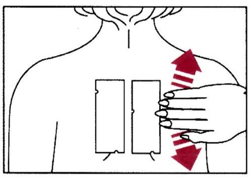 Mano che pizzica la pelle del braccio con due dita mostrando il punto di iniezione indicato da frecce rosse