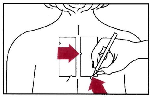 Schizzo di una spalla con indicazioni per l
