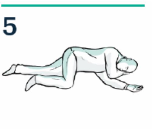 Paziente in posizione prona con braccia piegate e testa rivolta lateralmente verso destra