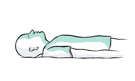 Paziente in posizione supina con evidenziate le aree di iniezione intramuscolare su gluteo e coscia