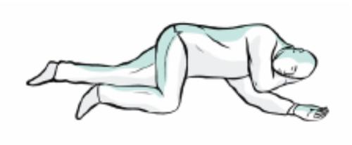 Paziente in posizione prona con la testa girata a destra e braccia piegate sotto il corpo