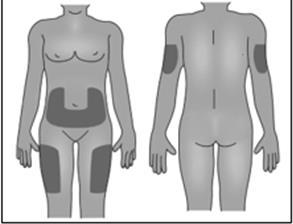 Schema corporeo femminile con aree ombreggiate che indicano possibili siti di iniezione sottocutanea su fianchi e cosce