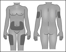 Corpo umano stilizzato visto frontalmente e posteriormente con aree ombreggiate su fianchi, glutei, cosce e spalle