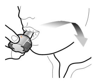 Dispositivo autoiniettante grigio con ago inserito nella piega cutanea e freccia che indica la direzione di iniezione