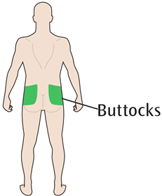Figura stilizzata di schiena umana con evidenziate in verde le zone dei glutei indicate dalla scritta