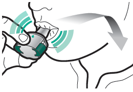 Mano che applica un cerotto medicinale su una zona del braccio, con freccia curva che indica la direzione di applicazione e area evidenziata