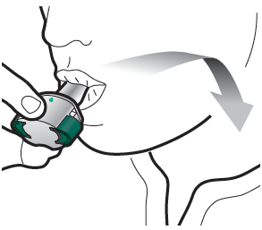 Mano che applica un dispositivo autoiniettante sulla coscia con freccia grigia che indica la direzione di iniezione