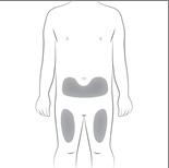 Schema del corpo umano con evidenziate in grigio le aree di iniezione nell