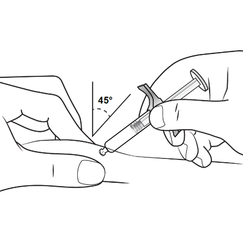 Mano che tiene una siringa preraempita inclinata a 45 gradi durante l