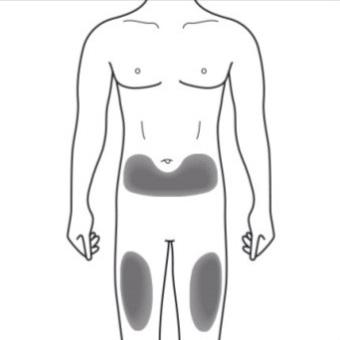 Schema del corpo umano con aree ombreggiate che indicano possibili siti di iniezione addominale e nelle cosce