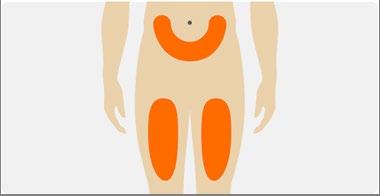 Torso umano stilizzato con evidenziate in arancione le aree di iniezione intramuscolare nella regione glutea e cosce