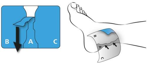 Piede con area blu evidenziata per iniezione sottocutanea e schema con freccia nera indicante la direzione di inserimento dell