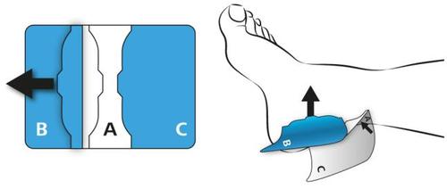 Iniezione sottocutanea nel gluteo con ago inclinato e area di iniezione divisa in sezioni A, B e C indicate da frecce