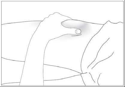 Mano che pizzica la pelle del braccio, formando una piega, con l