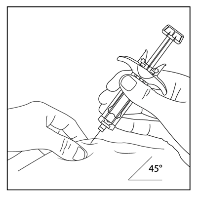 Mano che tiene una siringa preriempita inclinata a 45 gradi mentre inietta il farmaco nella pelle del braccio
