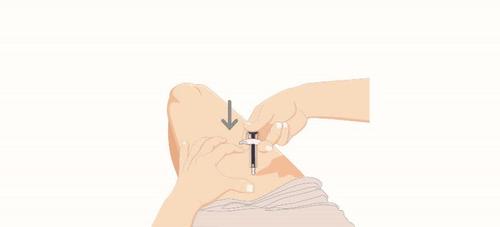 Mano che afferra un dispositivo autoiniettante premuto sulla coscia con una freccia nera che indica la pressione