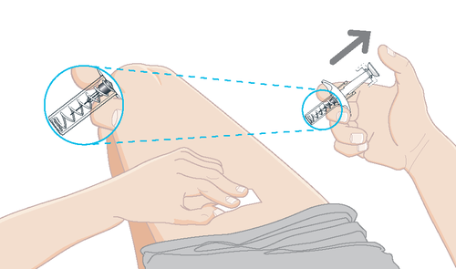 Iniezione sottocutanea eseguita su una coscia con siringa, dettaglio ingrandito dell