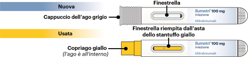 Siringa preriempita con due sezioni indicate come nuova e usata con etichette &ldquo;Ilumetri&rdquo; e dosaggio 100mg tildrakizumab