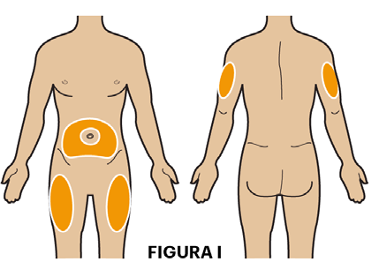 Corpo umano visto frontalmente e posteriormente con aree color arancione che indicano possibili siti di iniezione addominale, glutei e braccia