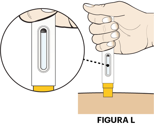 Mano che tiene un iniettore preriempito giallo con finestra trasparente e dettaglio ingrandito del meccanismo di rilascio