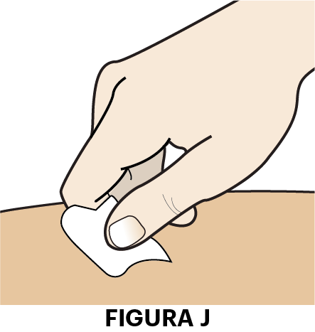 Mano che tiene un tampone di cotone bianco premuto sulla pelle color pesca dopo l